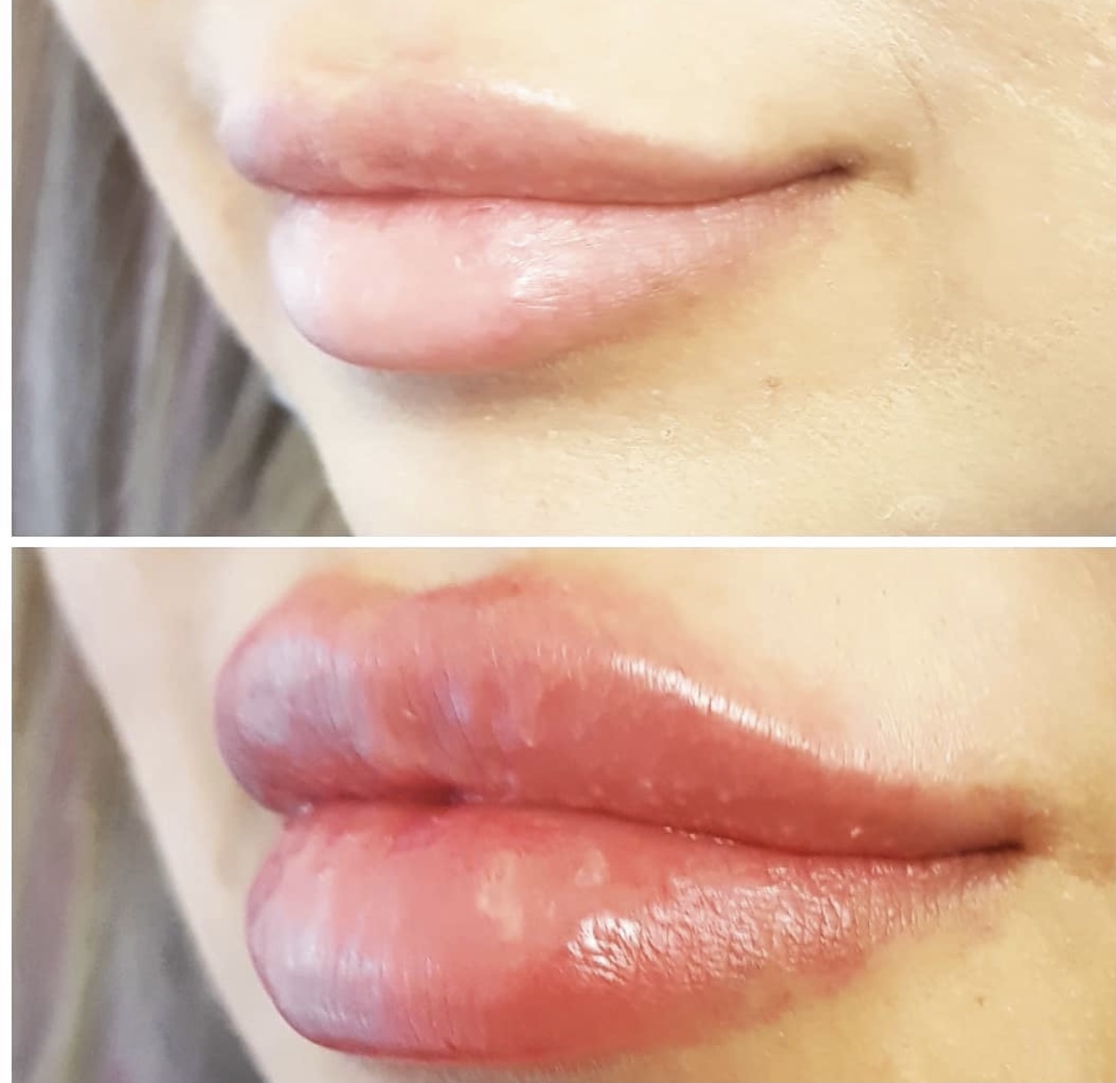 comparison of lips